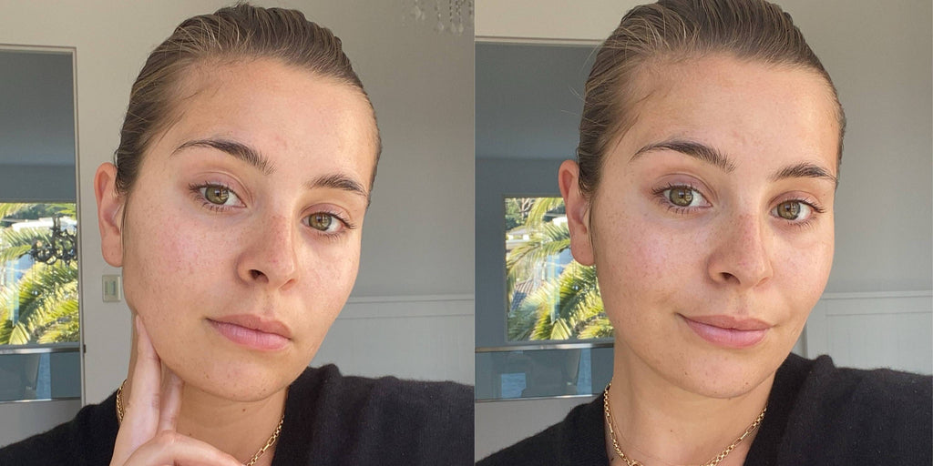 My Combination Skin Loves Hemp Seed Oil. Here’s Why